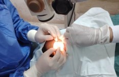 عمليات الرمد