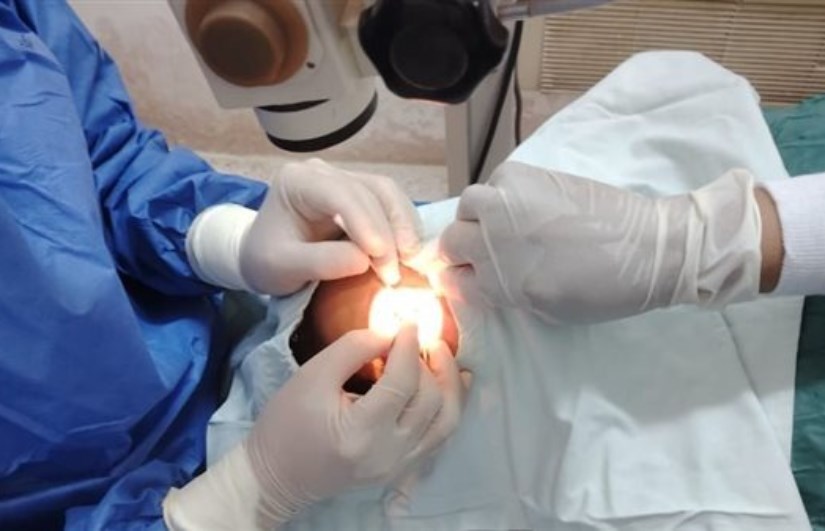 عمليات الرمد